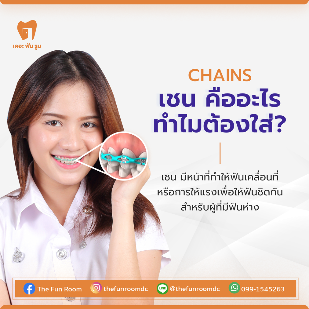 Power-Chains หรือ C-Chains