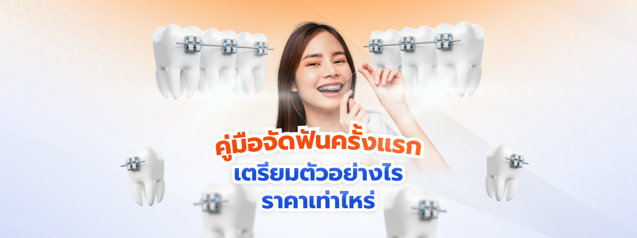 คู่มือ จัดฟัน ฉบับสมบูรณ์ 2026: สรุปครบทุกประเภท ขั้นตอนเตรียมตัว และเจาะลึกงบประมาณที่ต้องรู้