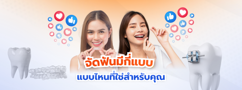 จัดฟันมีกี่แบบ เจาะลึก 5 ระบบยอดนิยม พร้อมวิธีเลือกให้เป๊ะกับไลฟ์สไตล์และงบประมาณของคุณ