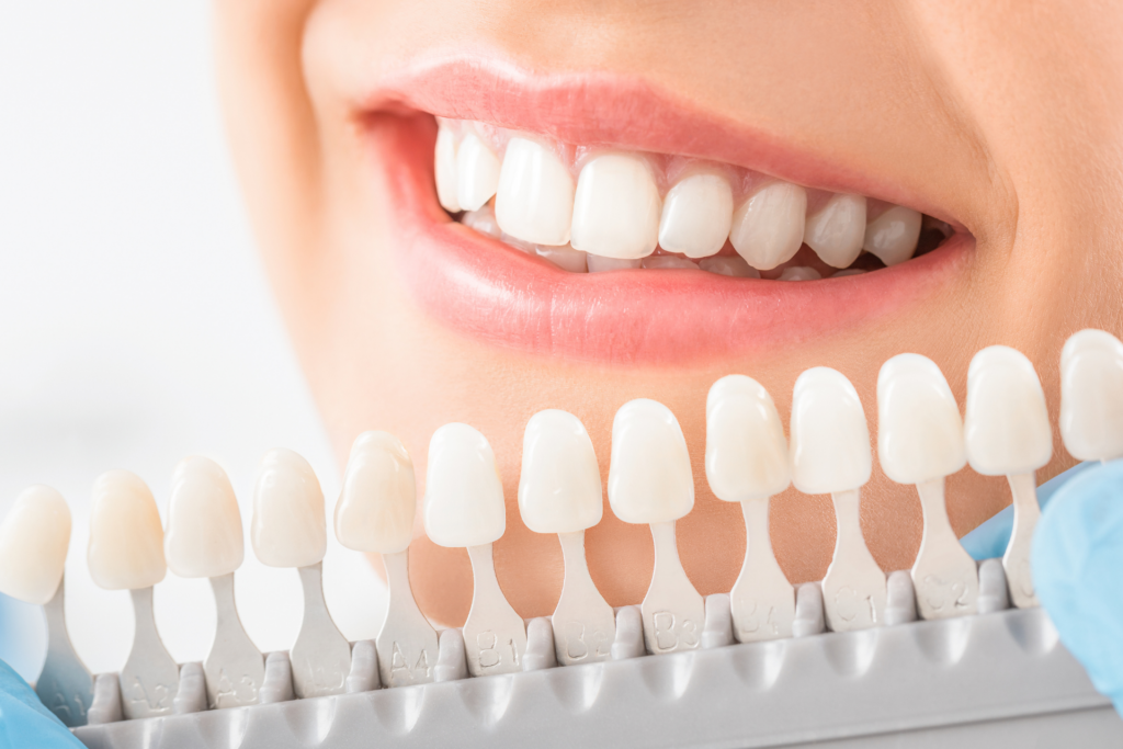 คู่มือ ฟอกสีฟัน ฉบับสมบูรณ์ เจาะลึกระบบ Cool Light และ Home Whitening พร้อมเทคนิคการล็อกความขาวและเช็กราคาปี 2026 ที่ คลินิกทำฟัน ลาดกระบัง