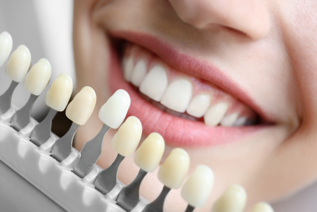 คู่มือ ฟอกสีฟัน ฉบับสมบูรณ์ เจาะลึกระบบ Cool Light และ Home Whitening พร้อมเทคนิคการล็อกความขาวและเช็กราคาปี 2026 ที่ คลินิกทำฟัน ลาดกระบัง