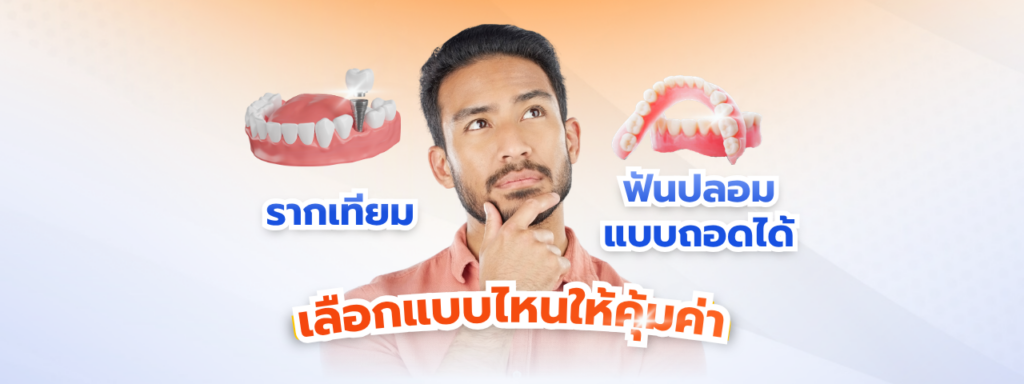 เจาะลึกความต่างระหว่างรากเทียม และ ฟันปลอมแบบถอดได้ ทั้งมิติด้านชีวกลศาสตร์ ข้อดี-ข้อจำกัด และราคาปี 2026 ที่ คลินิกทำฟัน ลาดกระบัง