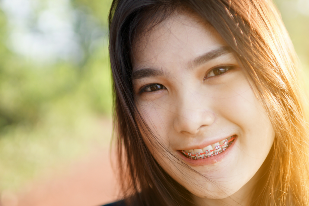 จัดฟันมีกี่แบบ? จัดฟันแบบไหนดี ทั้ง 5 แบบ ทั้งโลหะ AOSC Damon Clear Aligner และ Invisalign พร้อมข้อดี-ข้อด้อย 