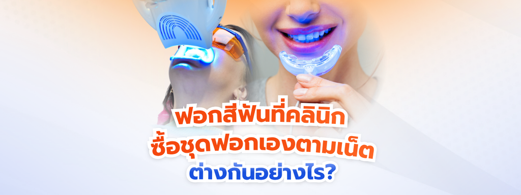 ฟอกสีฟันที่คลินิก VS ซื้อชุดฟอกเองตามเน็ต ต่างกันอย่างไร? แบบไหนปลอดภัยและเห็นผลจริง