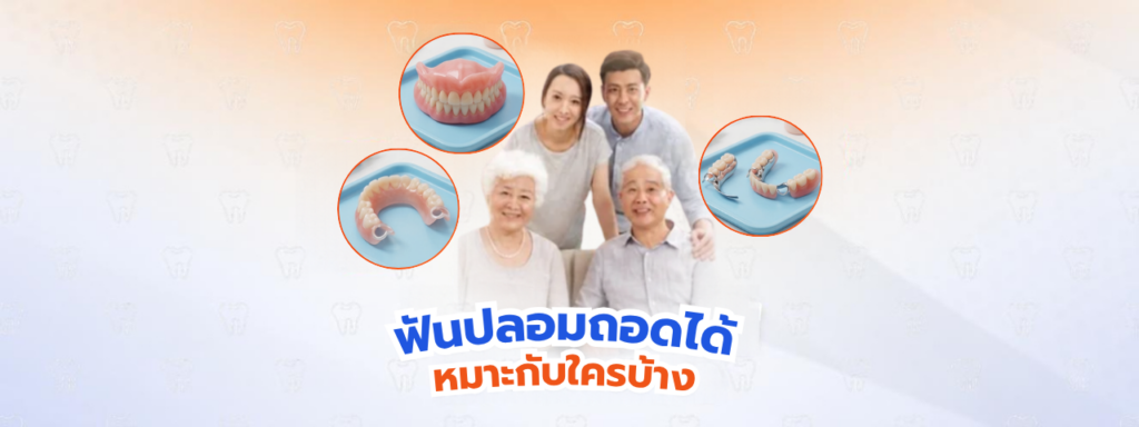 ฟันปลอมถอดได้ เหมาะกับใครบ้าง พร้อมวิธีใส่และดูแลรักษาให้ใช้งานได้นาน