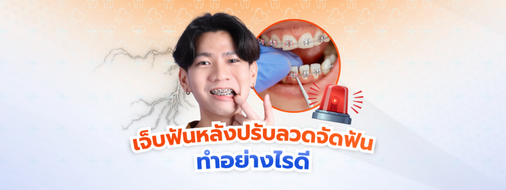 เจ็บฟันหลังปรับลวดจัดฟันทำอย่างไรดี รวมเทคนิคบรรเทาความระบมและเลือกกินอาหาร